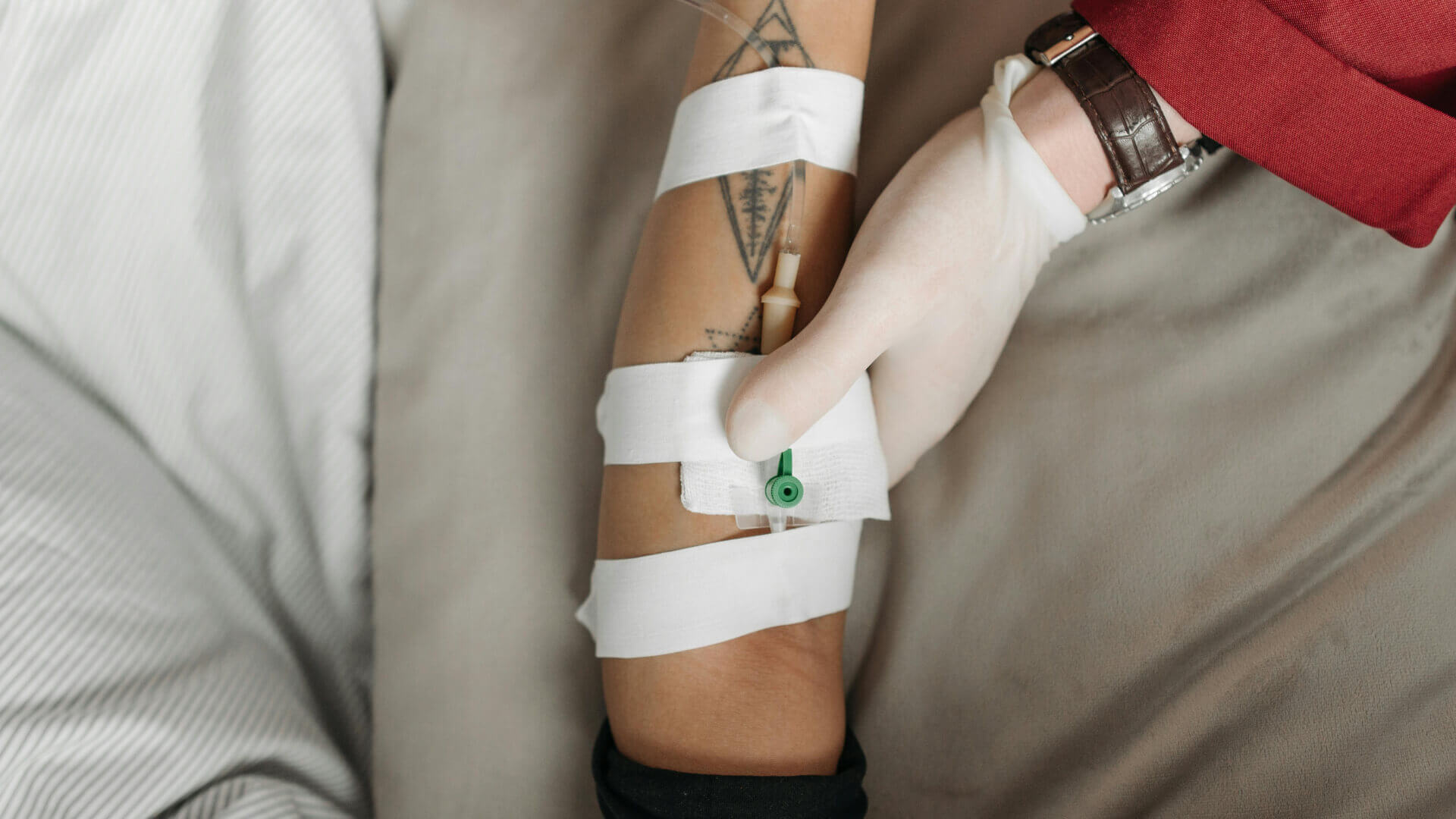 Arm Intravenous Image